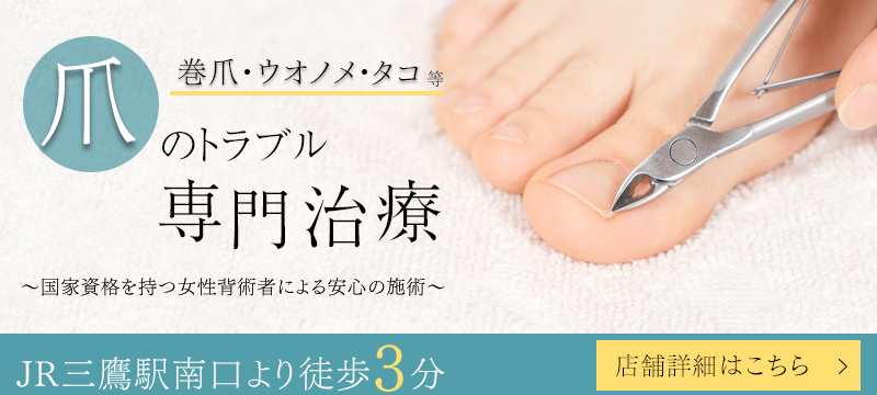 深爪の基準はどこから?切り過ぎがダメな理由や正常に戻す方法を徹底解説 | 三鷹市の巻き爪治療なら|巻爪専門三鷹院